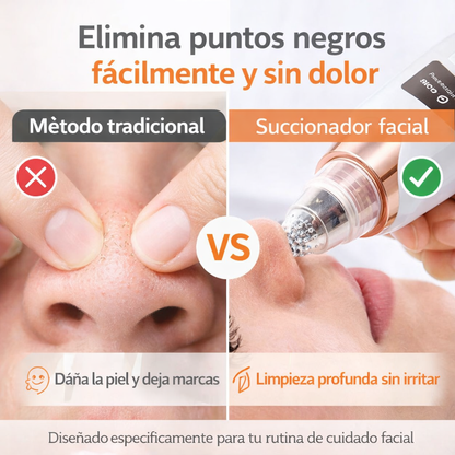 PoreClear Pro® | Removedor de Puntos Negros