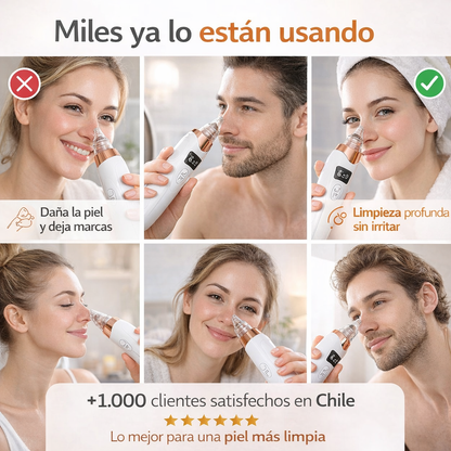 PoreClear Pro® | Removedor de Puntos Negros